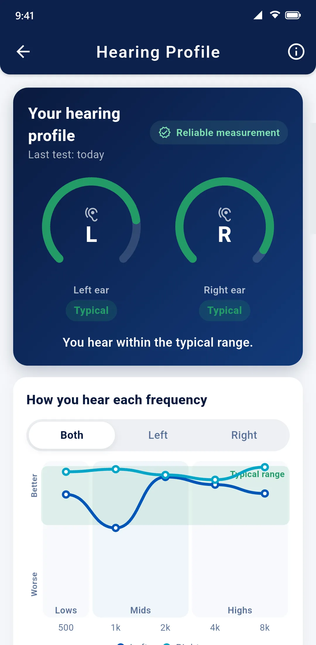 Hearing profile: both ears in the usual range and a chart of how each frequency is heard.